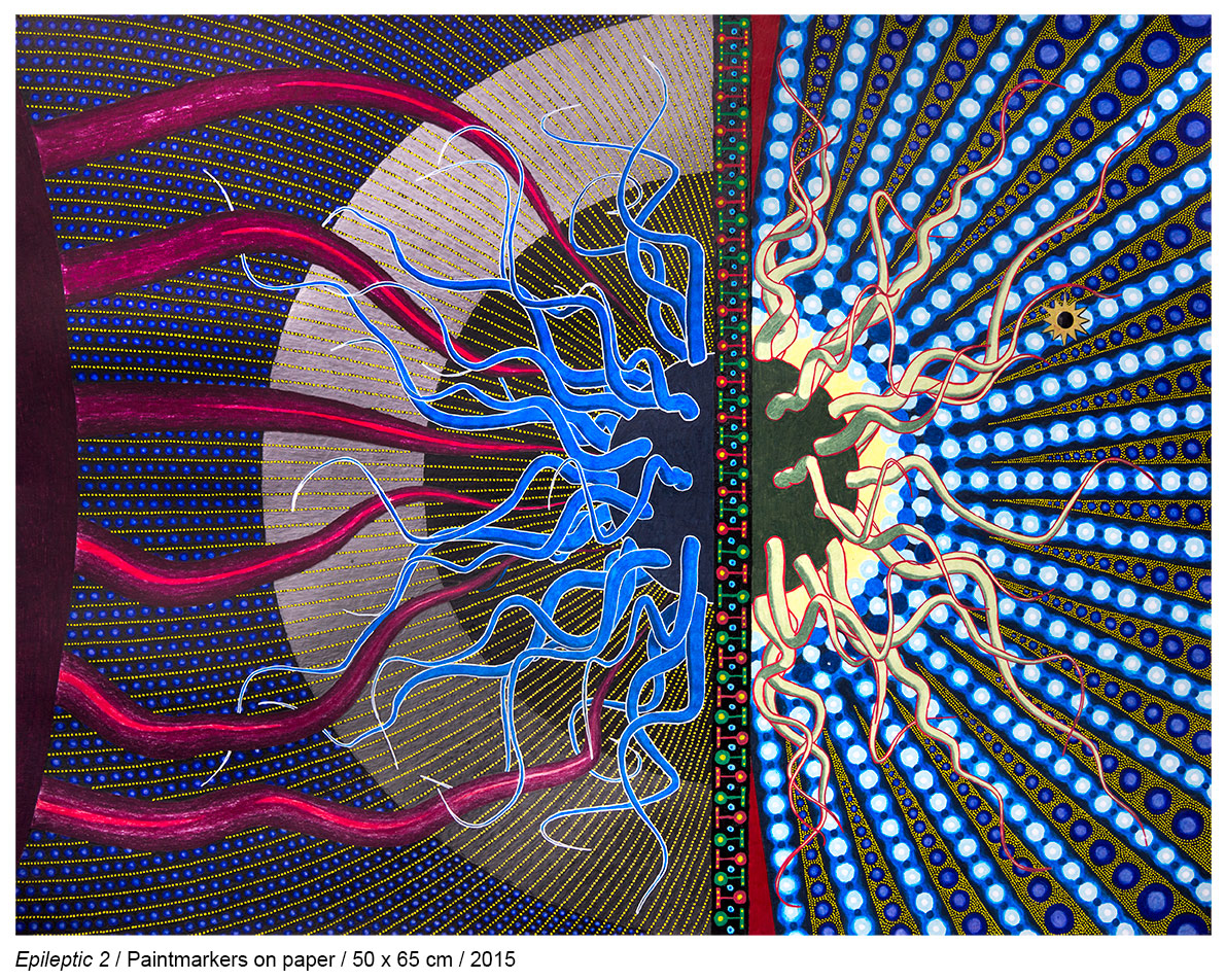 2015-Epileptic2